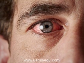 日常眼球运动可能是正常眼压患者发生青光眼的原因