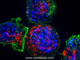 慢性炎症如何提示免疫细胞平衡促进肝癌